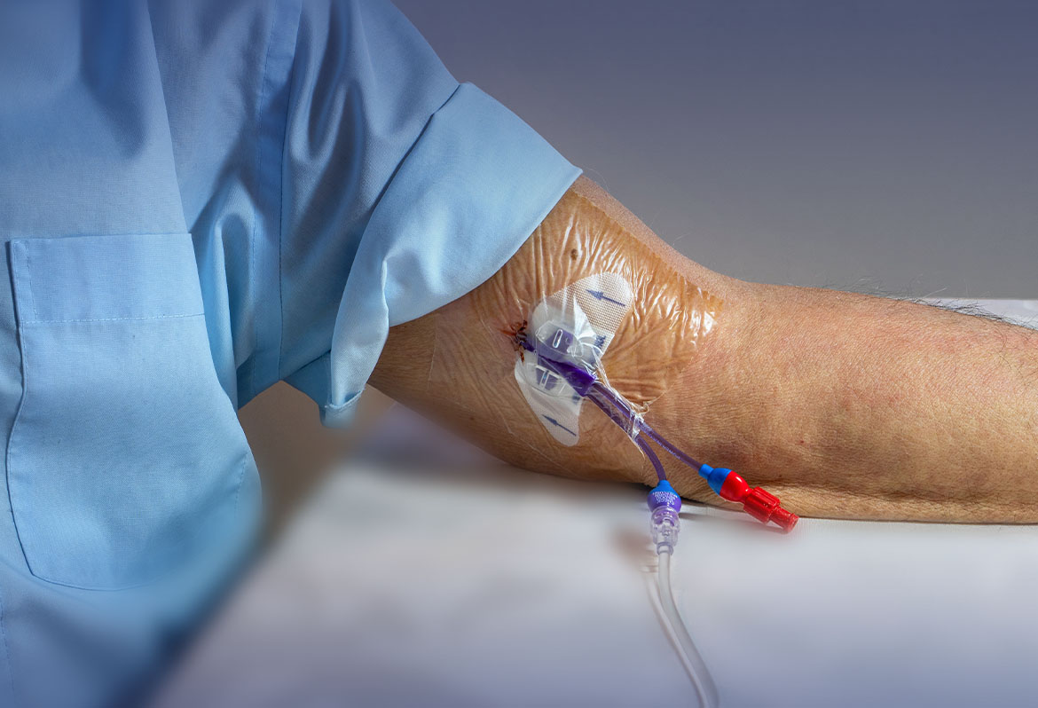 se accesso vascolare fallisce - le cause