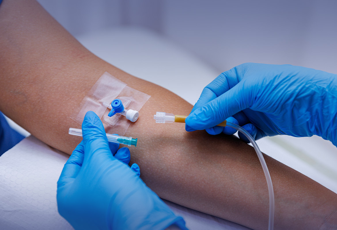 impatto accesso vascolare sul comfort del paziente